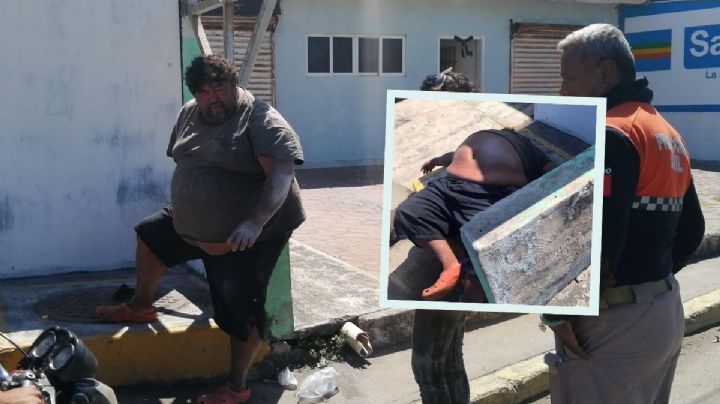 "No me morí, estoy crudo", el Cara Bonita asusta a rescatistas de Alvarado