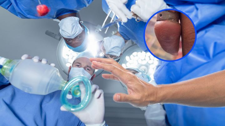 Le salvan el dedo en Ixmiquilpan por argolla atorada; así se veía