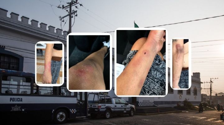 “Fui parte de una cuota”: Odontóloga narra detención arbitraria en Veracruz