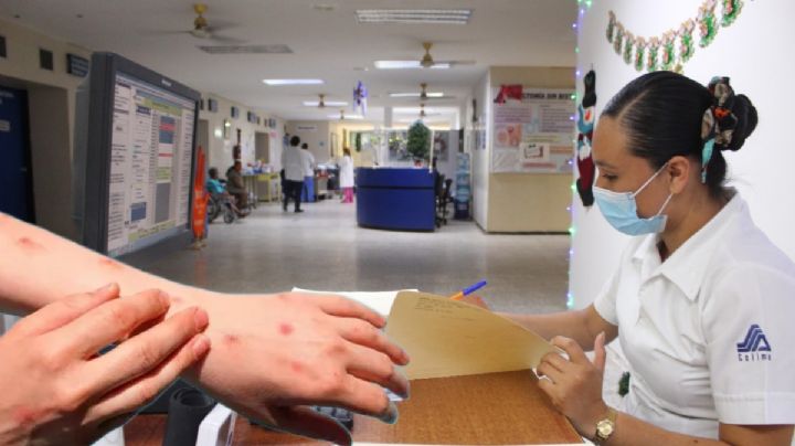 Se duplican contagios de varicela en Hidalgo; así se detectan los primeros síntomas