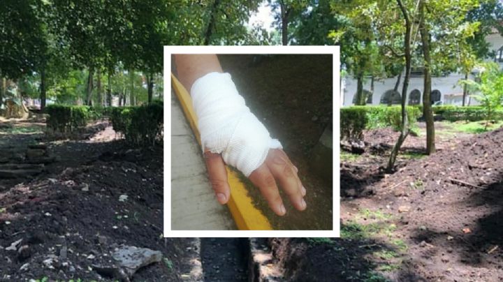 "Me prendió la cara con gas y encendedor", Salvador narra agresión en Xalapa