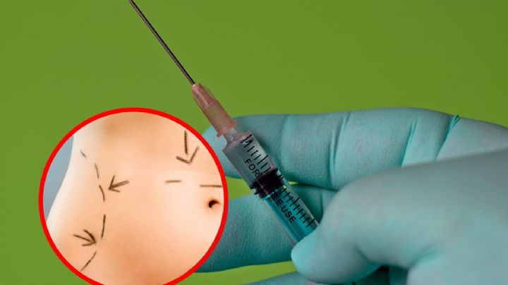 ¿Quién era Karina, la enfermera que encontró la muerte en liposucción fallida?