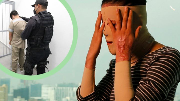 Presentan "Ley Leslie" en Hidalgo; hay 14 víctimas de violencia ácida en espera de justicia