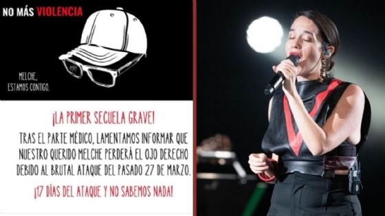 Manager de Ximena Sariñana perderá su ojo derecho tras ataque en la Feria del Caballo