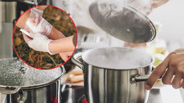 Como prevenir quemaduras de niños en casa y que hacer si ocurre