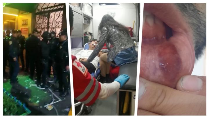 Violencia en bar Cabaretito de Zona Rosa: violación, golpes y robo