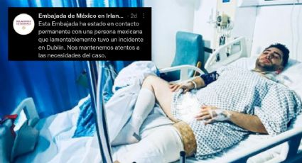Embajada de México en Irlanda no ha hecho nada: Veracruzano atacado en Dublín