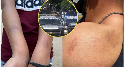 No pensé que iba a sobrevivir: víctima de abuso policial en Edomex