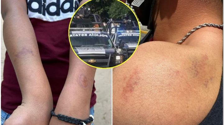 No pensé que iba a sobrevivir: víctima de abuso policial en Edomex