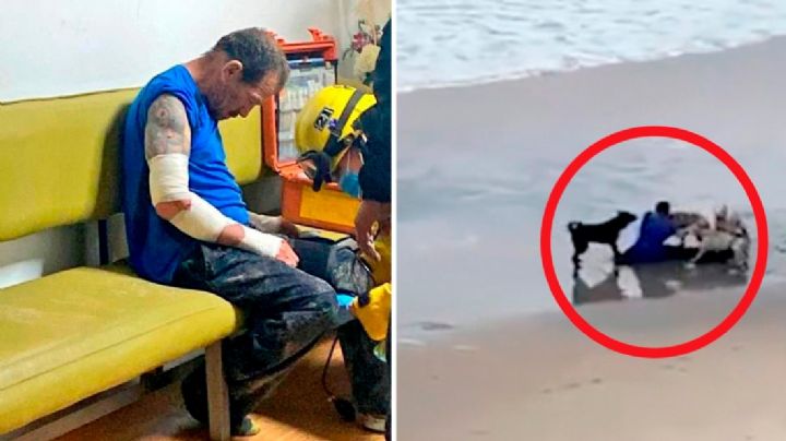 VIDEO | Así fue el brutal ataque de perros a un hombre en Playas Tijuana