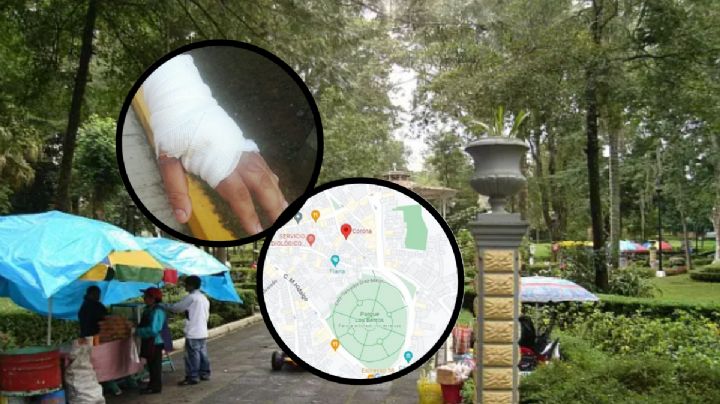 Caen padre e hija por prender fuego en la cara a chef de Xalapa