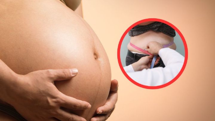 Embarazo y sobrepeso: Así se puede ver afectado tu bebé