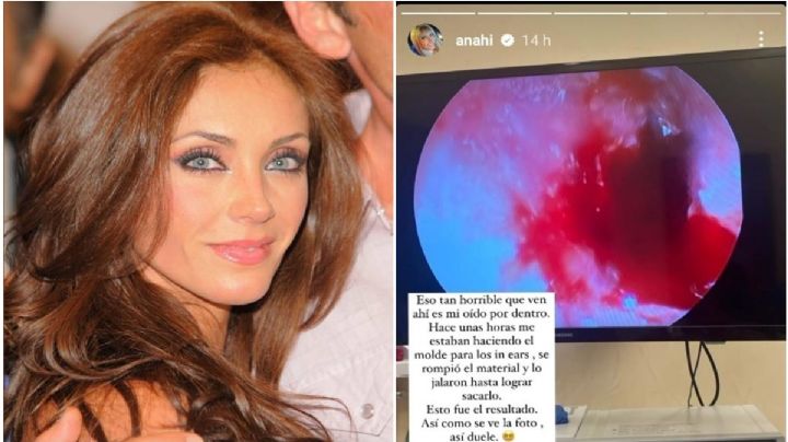 Anahí fue a dar al hospital por este accidente en su oído; esto debes saber