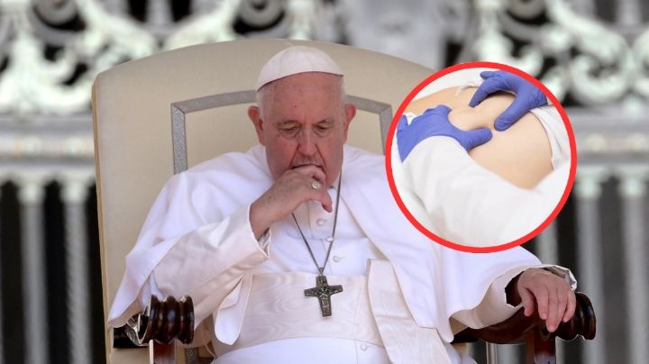 Hernia abdominal, ¿qué es el padecimiento que llevó al Papa Francisco al quirófano?