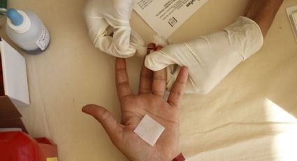 Confirman sexto caso exitoso de paciente con VIH tras recibir trasplante de médula ósea