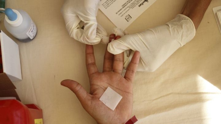 Confirman sexto caso exitoso de paciente con VIH tras recibir trasplante de médula ósea