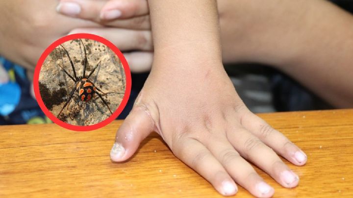 Por querer convertirse en el Hombre Araña, niño se deja picar por Viuda Negra