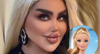 El antes y el después de la mujer que se hizo 43 cirugías para ser como Barbie