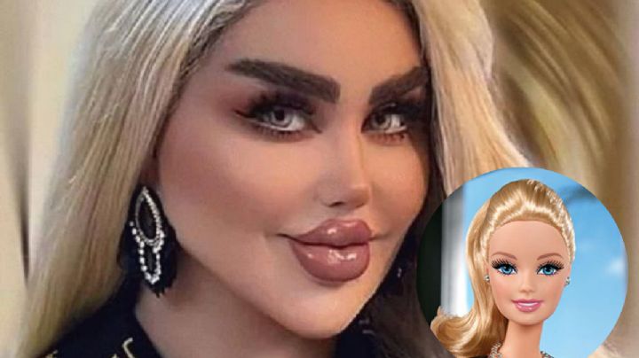 El antes y el después de la mujer que se hizo 43 cirugías para ser como Barbie