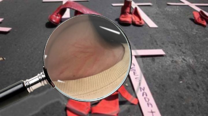 A Frida la intentó degollar su expareja, MP dijo que fue violencia familiar; busca justicia