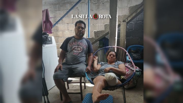 Lesvi y Pedro: camión de valores les destroza sus piernas y sus vidas