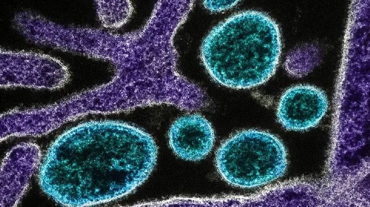 Nipah: Los síntomas y claves del nuevo virus mortal