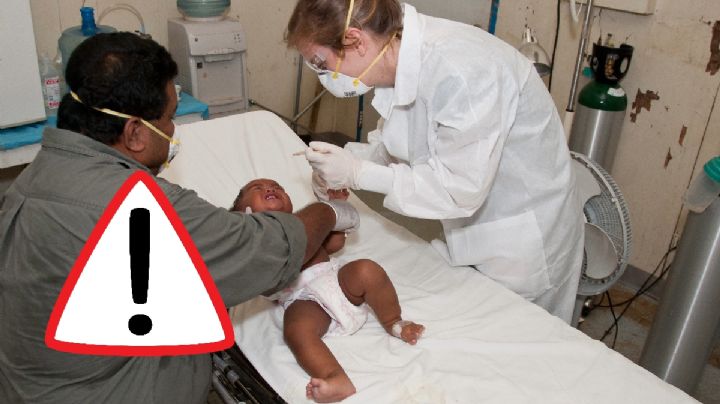 Virus sincitial: Qué es, cómo se contagia, síntomas y cómo afectaría a México