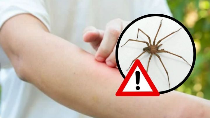 ¿Araña violinista picó a trabajador en Xalapa? Esto dijeron autoridades