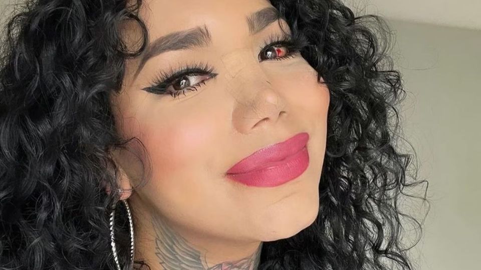 La comunidad de seguidores de Paola Suárez quedó paralizada al ver las imágenes de la influencer con hematomas y el ojo inmovilizado