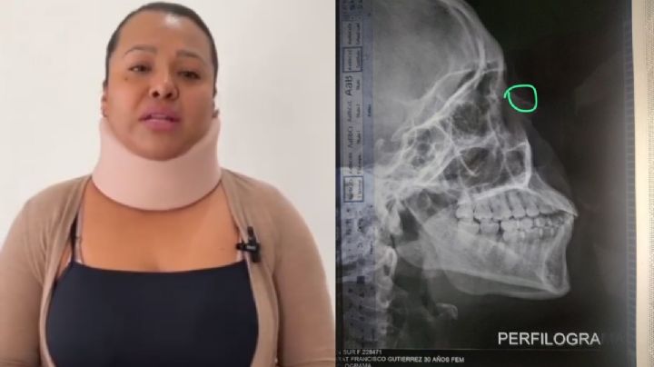 Monserrat es víctima de su expareja y del sistema; “quiero vivir sin miedo” su agresor está libre