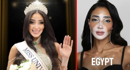 Ella es Logina Salah, la primera mujer con vitiligo que concursa en Miss Universo