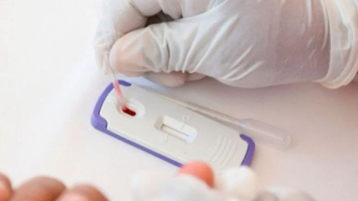 Contagios de VIH pasan de 290 a 352, alerta la Dirección Epidemiológica