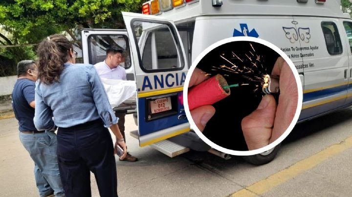 Menor de 9 años, a punto de perder un ojo por explosión de cohete en Jáltipan