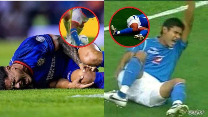Las lesiones más escalofriantes en Cruz Azul y que dejaron en el olvido a estos jugadores