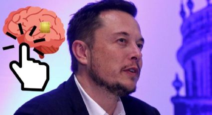 Elon Musk asegura que el chip cerebral implantado es capaz de mover un mouse con el pensamiento