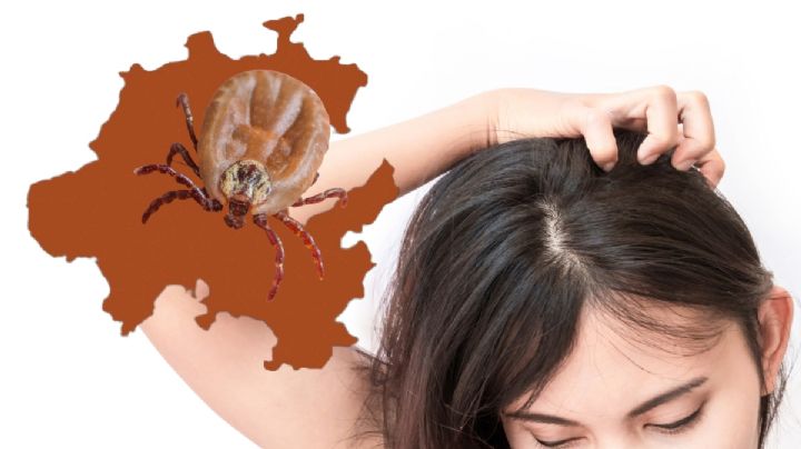 Brote de piojos en Hidalgo ¿qué hacer y por qué se producen?