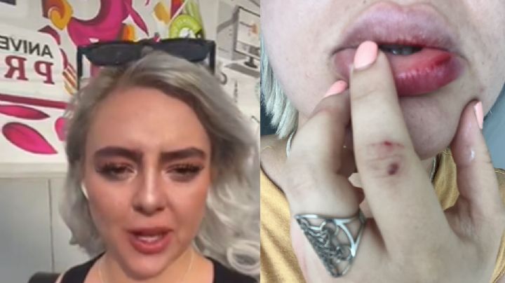 Ahora son golpes y lesiones las que denuncian contra titular de Profeco