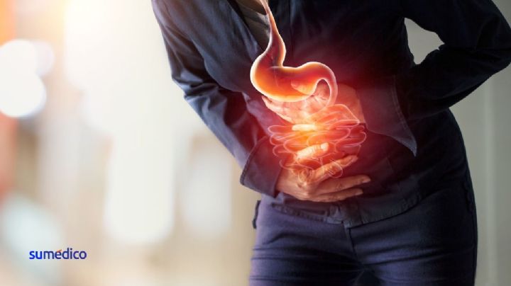 Los 5 síntomas de alerta sobre el cáncer de colon