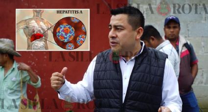 Alcalde de Zozocolco confirma 16 casos de hepatitis A, ¿qué es y cómo se transmite?