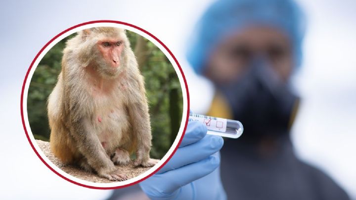 Alerta por primer caso de Virus del mono B; ¿qué es y cómo se contagia?