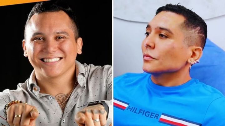 La tragedia detrás de Edwin Luna: quedó irreconocible por someterse a cambios estéticos