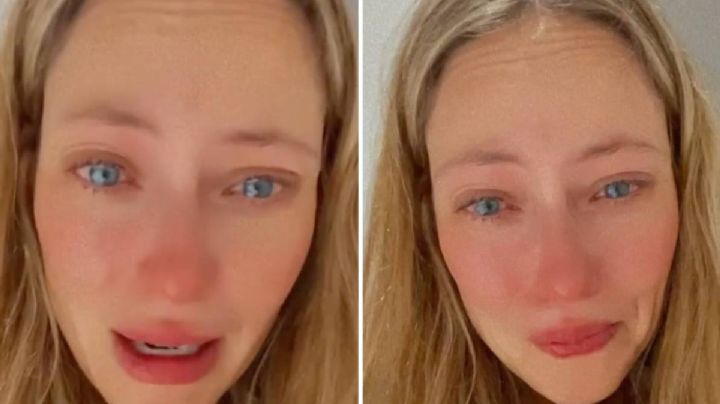 La verdad detrás de las ronchas que tiene Vanessa Huppenkothen en el cuerpo