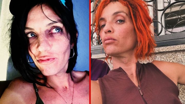 Hijo de Camilo Sesto preocupa por su deteriorado estado físico; "no puede ocultar su dejadez" | FOTO