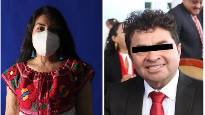 Caso saxofonista oaxaqueña: Agresor que la atacó con ácido podría ser libre