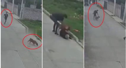 Joven paseaba con su perro sin correa, se le escapa y le destroza las piernas a una mujer