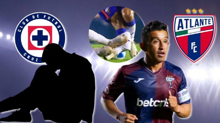 Las fracturas más espeluznantes en el futbol mexicano como la del "Hobbit" Bermúdez