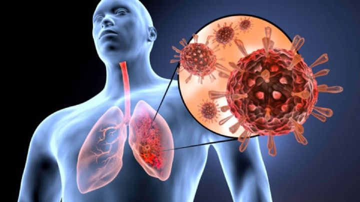 ¿Qué es el Metapneumovirus Humano, el virus que amenaza con convertirse en pandemia en 2025?