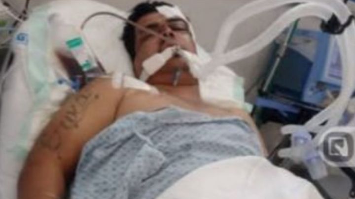 Por culpa de bache joven tiene fractura de cráneo, sus padres piden ayuda