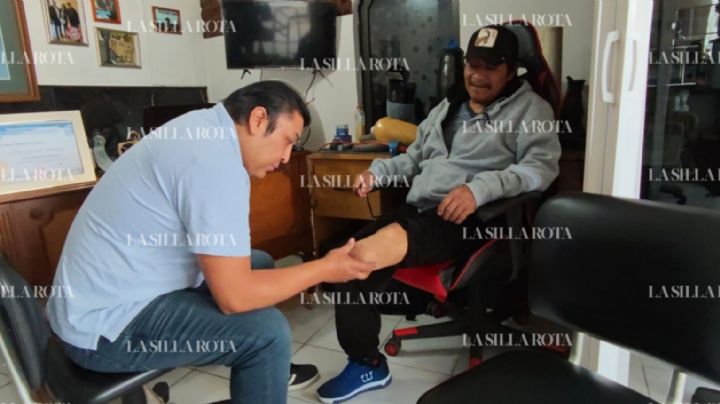 Low-Cost 3D Prosthetics Helping Uninsured Mexicans Walk Again