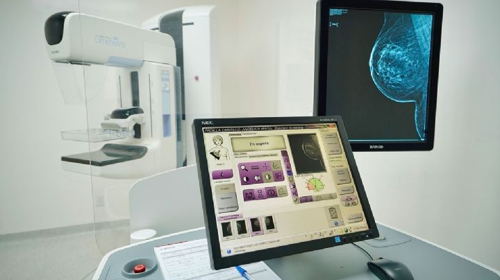 ¿Dónde puedo realizarme una mastografía gratuita o a bajo costo en México?